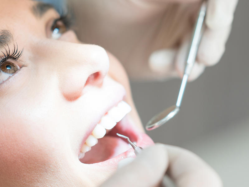 Patient reclined with open mouth and gloved hands utilizing dental instruments