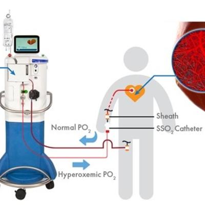 SSO2 system