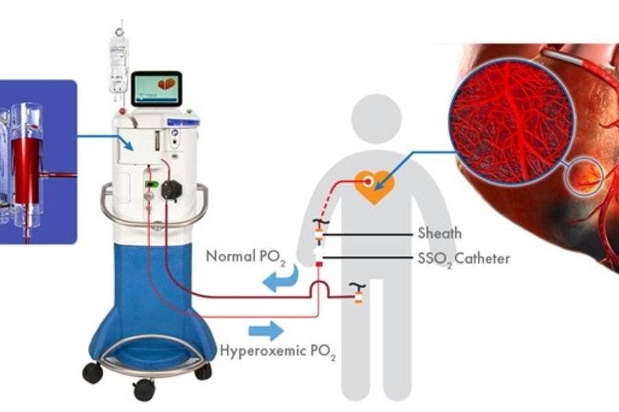 SSO2 system